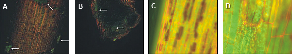 endophytic bacteria on the surface of a poplar root